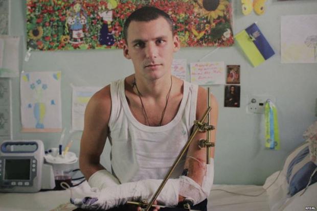 Девятілов Дмитро. Численні вогнепальні поранення. Складний перелом правої руки.  | Фото: Олександра Чекменьова