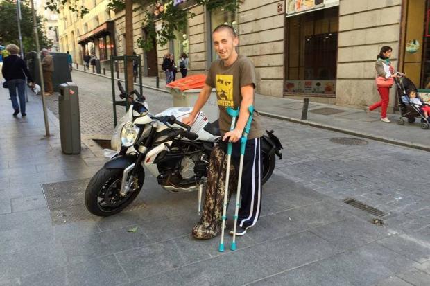 Василь Рокицький досі ходить на милицях і потребує операції | Фото: Поранені SOS/Facebook