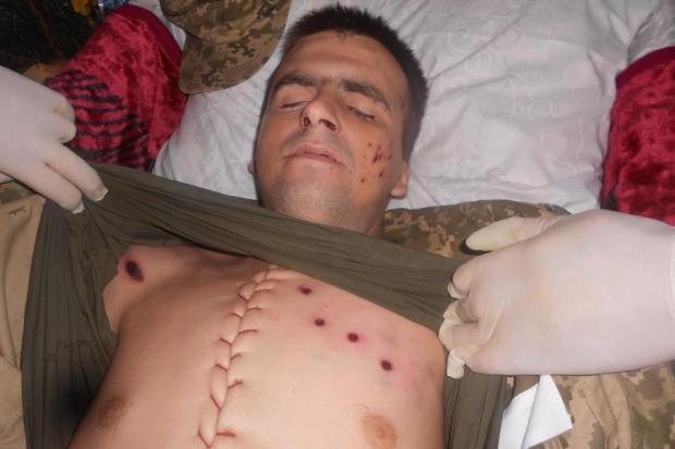 Рідні сфотографували тіло загиблого в АТО Миколи Ткачука | Фото: verchovyna.at.ua