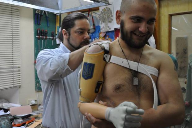 Фахівці протезуватимуть бійців АТО навесні