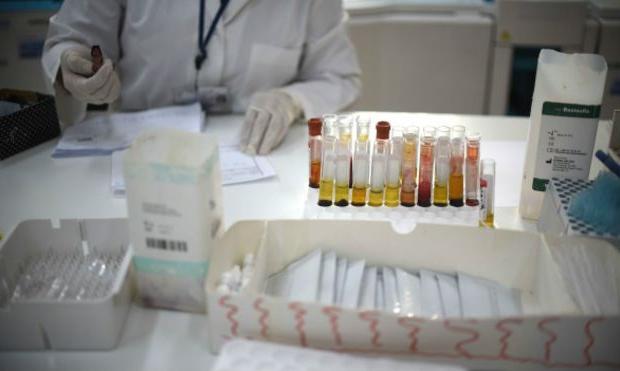 Нинішній спалах захворювання на вірус Зіка вчені називають найбільшим в історії.
 | Фото: bbc.com