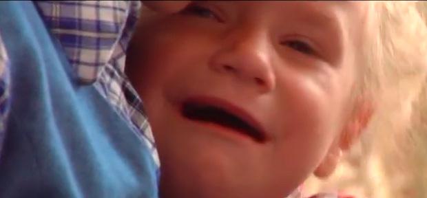 Через алкоголь і недоїдання у чотирирінчої дівчинки &mdash; психічні розлади | Фото: Скрін з відео