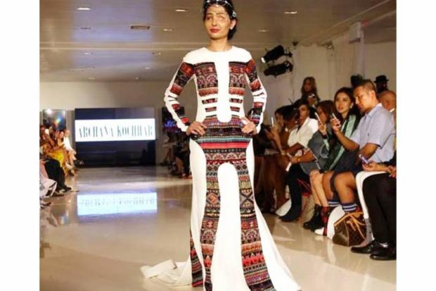 Модель з понівеченим обличчям стала зіркою Нью-Йорку | Фото: gazeta.ua