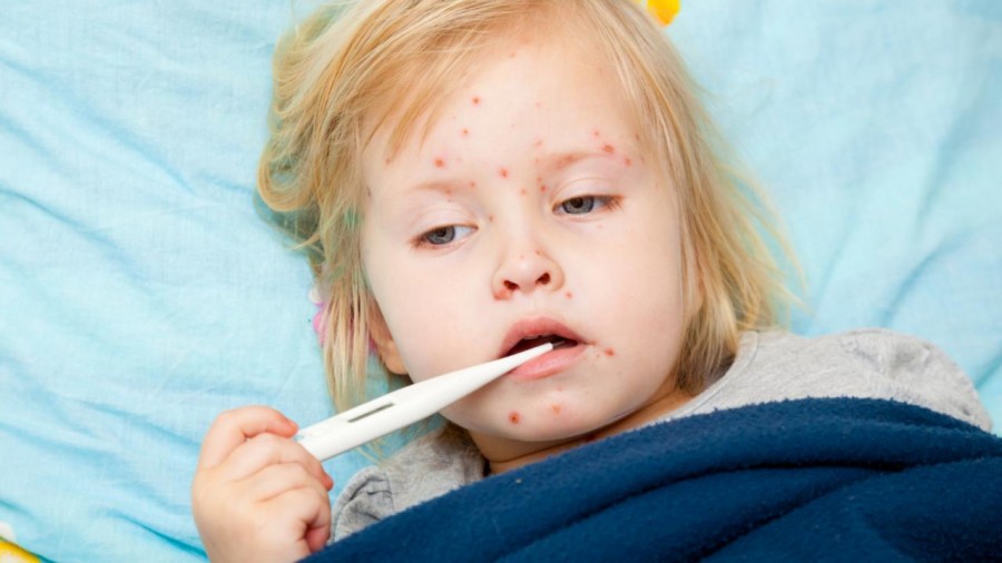 Кір &ndash; інфекційна хвороба, що вражає як дітей, так і дорослих, які не мають імунітету проти цього захворювання