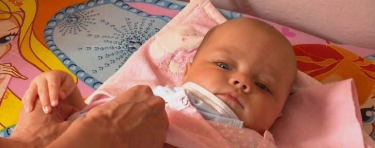 Дівчинка мусить жити у стерильних умовах через хворобу