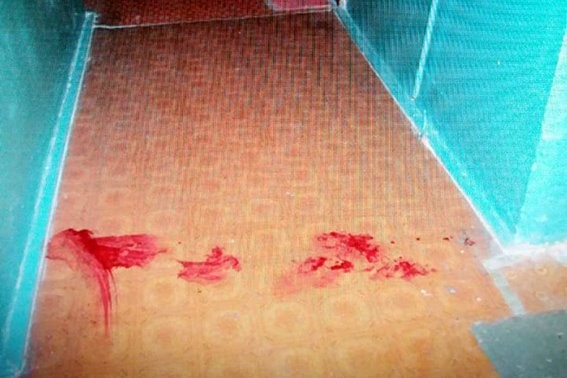 У Калуші правоохоронці затримали підозрюваного у нанесенні тяжких тілесних ушкоджень співчарочнику