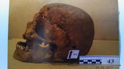 Під час експертизи на останках виявили понад півсотні переломів нижньої щелепи, зламані ребра, плечові та стегнові кістк