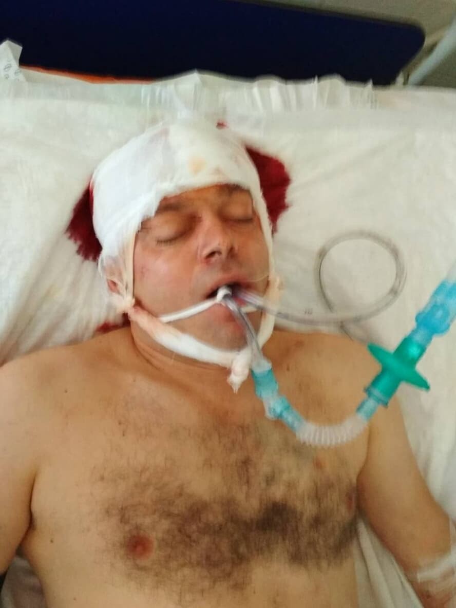 Чоловік лежав без свідомості на лавочці на вулиці Коновальця