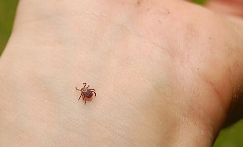 Ілюстрація. Неправильне видалення кліща наражає на небезпеку постраждалого.
