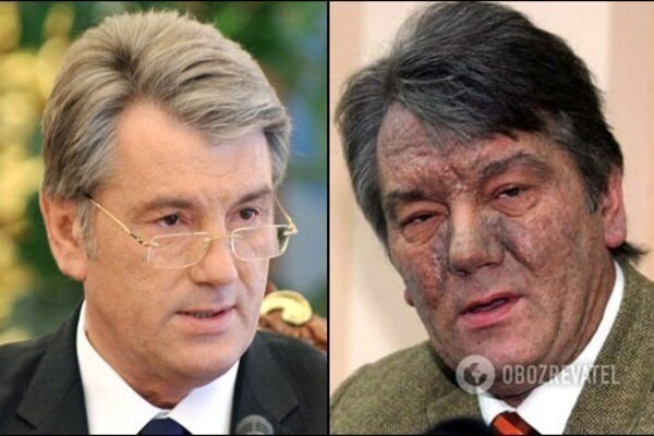 Ілюстрація. Один із учасників групи слідчих стверджує, що є докази умисного отруєння Віктора Ющенка.