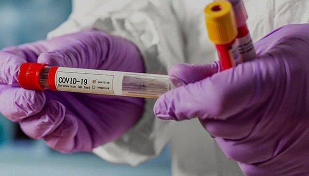 Ілюстрація. Мобільні групи будуть виїжджати до осіб з підозрою і відбирати в них аналіз на дослідження