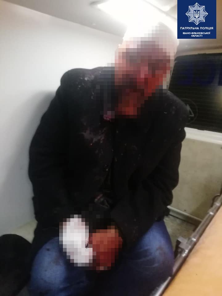 Патрульні затримали усіх учасників конфлікту та викликали бригаду швидкої.