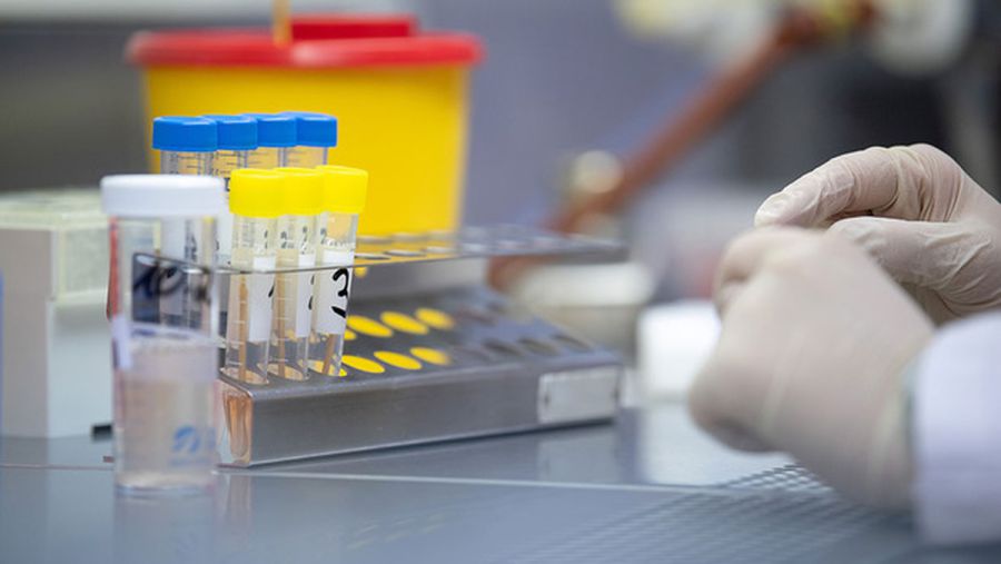 Обов’язковою умовою для переведення в Калуську райлікарню буде негативний результат ПЛР-тесту