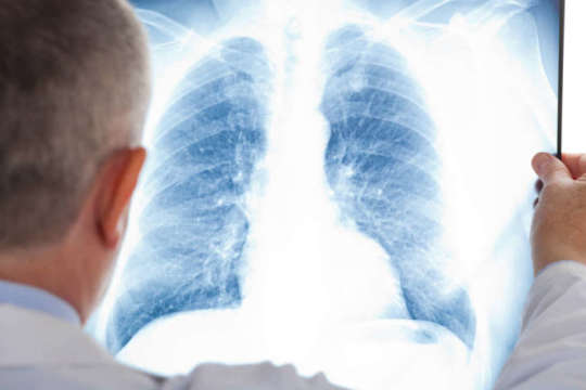 Ілюстроване фото. Дослідження тривало півтора року.