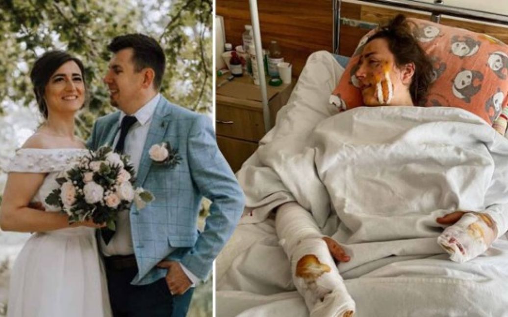 Жінка все ще проходить лікування в мед закладі.