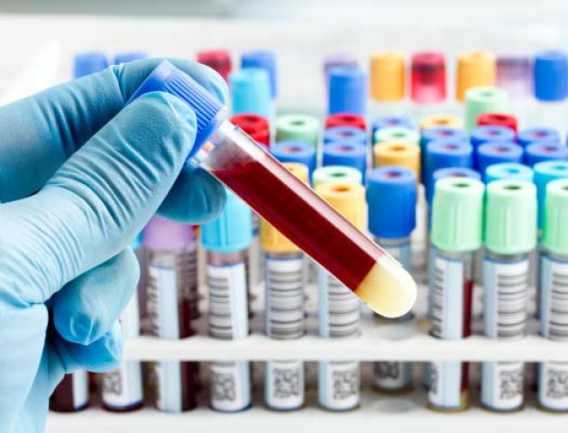 Ілюстроване фото. Планується відновлення пунктів збору аналізів.