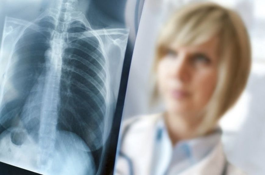 Ілюстроване фото. Прикарпаття входить до п'ятірки регіонів України по поширенню туберкульозу.