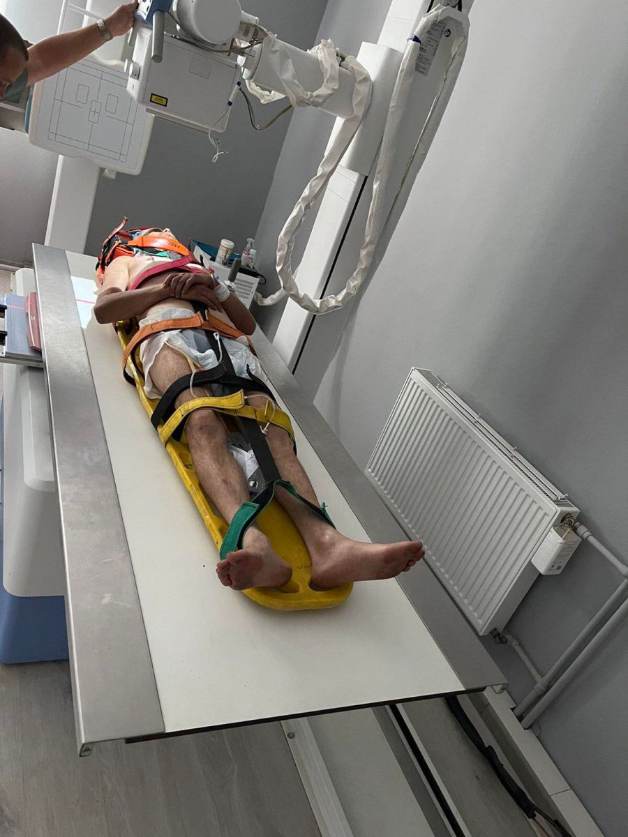 Причиною падіння очевидці називають приступ епілепсії