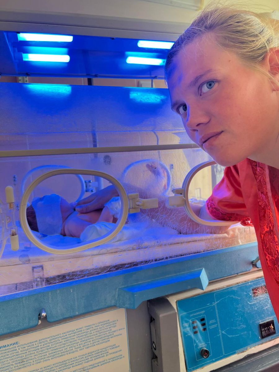 Хлопчику неонатологи допомагають вилікувати жовтяницю