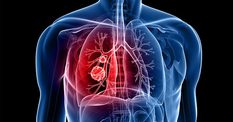 Постанова розширює програму реімбурсації двома новими комбінованими лікарськими засобами