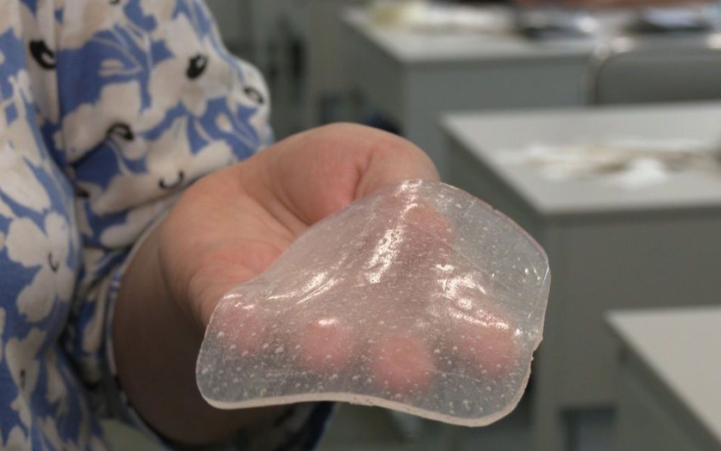 Такий винахід стане у пригоді нашим бійцям.