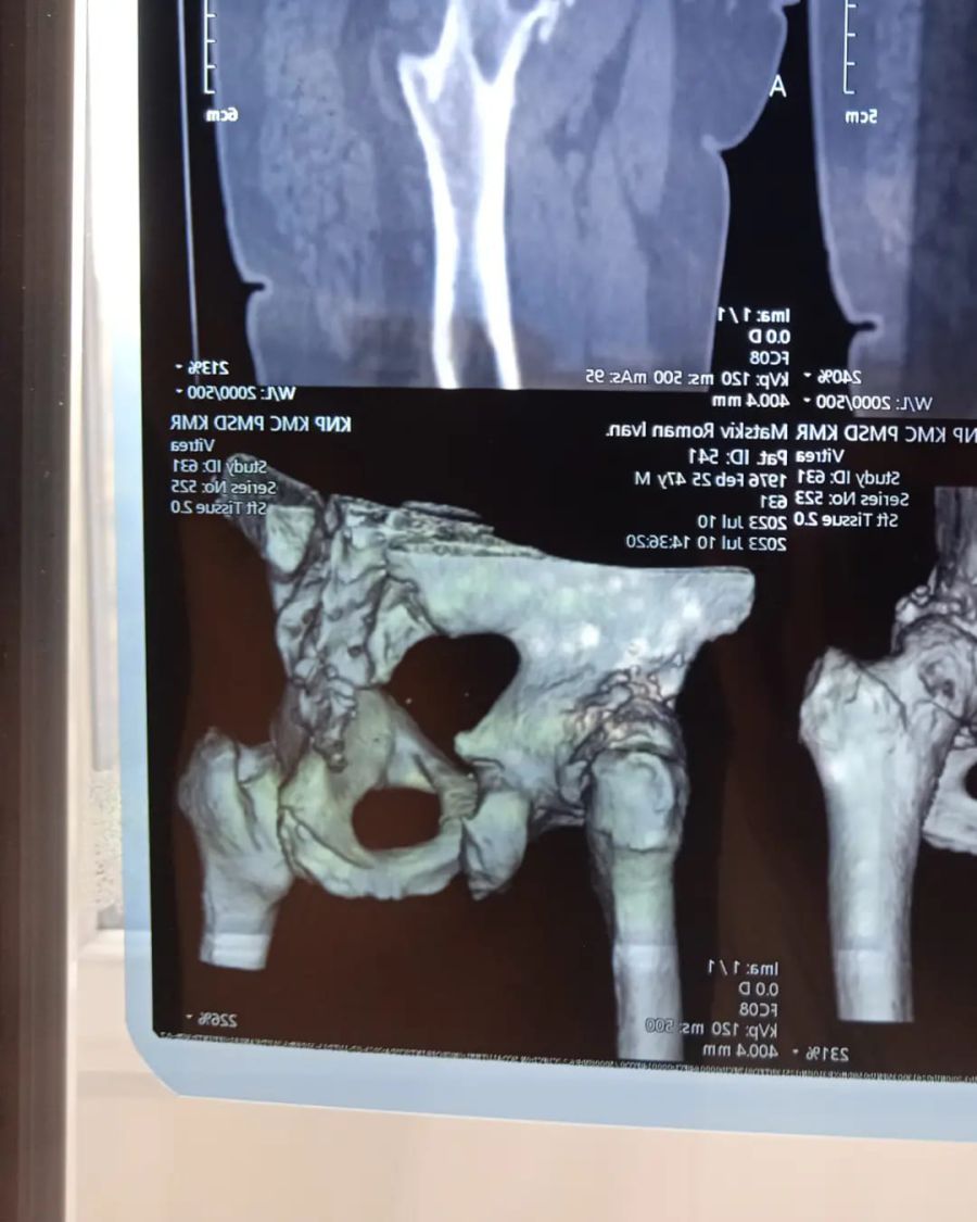 Операцію потрібно провести якнайшвидше.