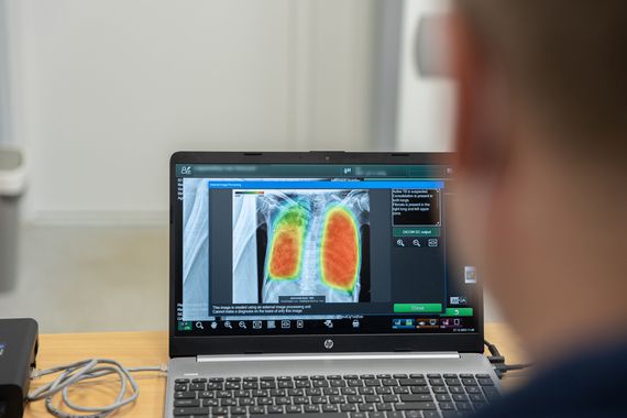 Ілюстроване фото. За минулий рік на Прикарпатті зареєстрували 493 вперше виявлених випадків.