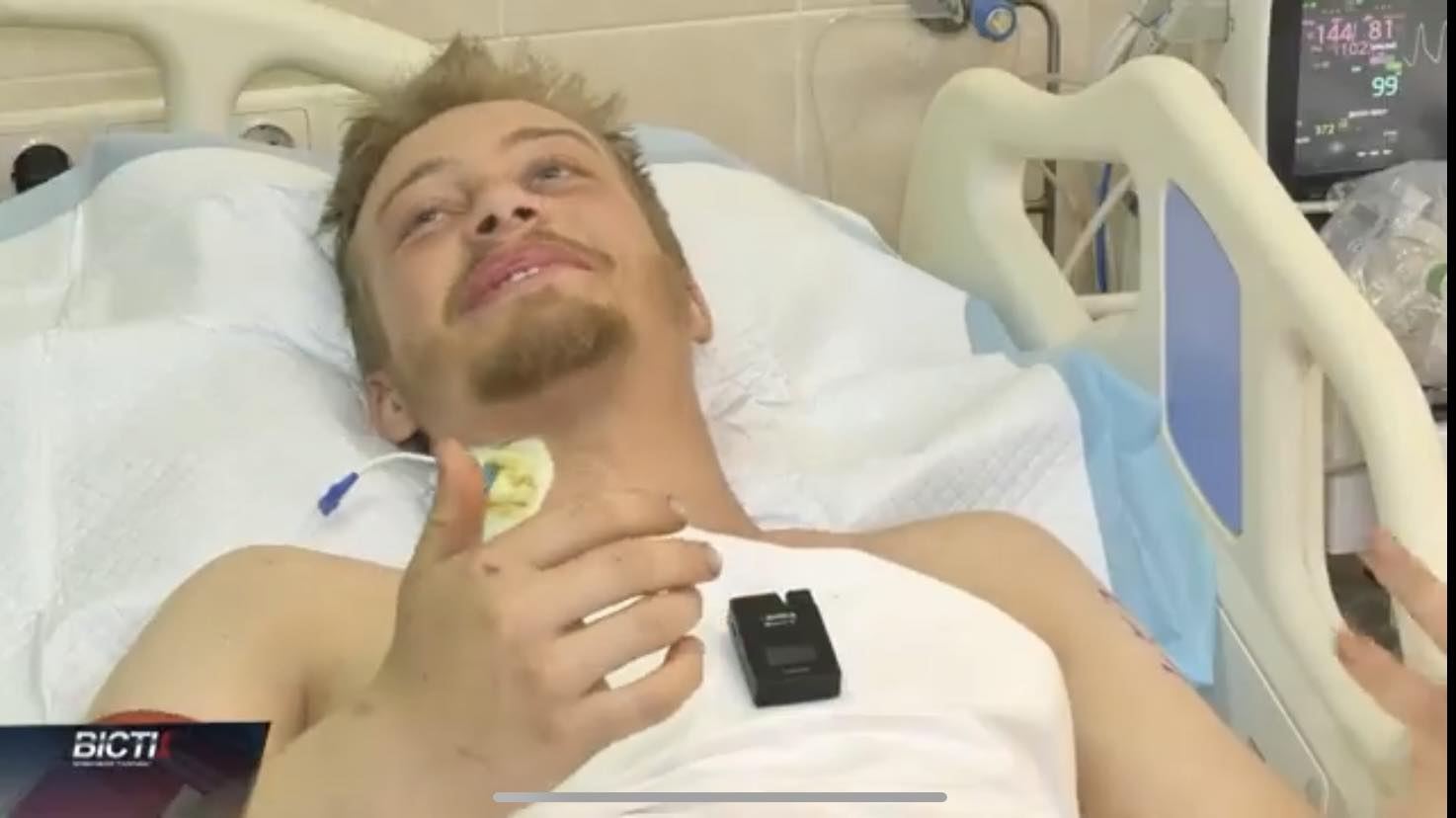 Михайло мріє отримати протез і стати на ноги