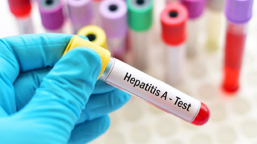 Ілюстроване фото. Від початку 2024 року на Івано-Франківщині зареєстрували 50 випадків.