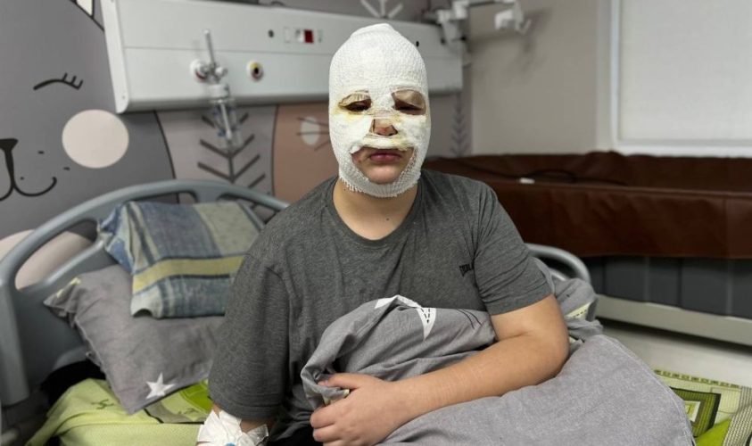 Серед пацієнтів лікарні святого Миколая – 11-річний Вʼячеслав із Львівщини