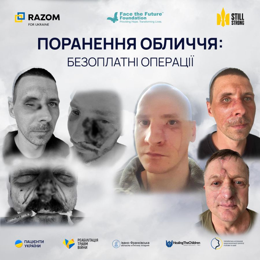 Ілюстроване фото. Всі операції безоплатні для пацієнтів