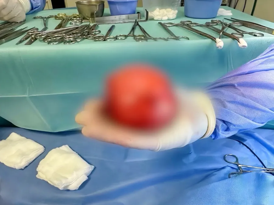 Медики виявили у немовляти вроджену прогресуючу пухлину нижньої долі лівої легені