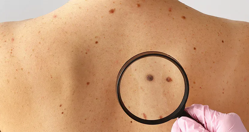 Ілюстроване фото. Перше постачання інноваційних ліків очікується наприкінці червня 2026 року