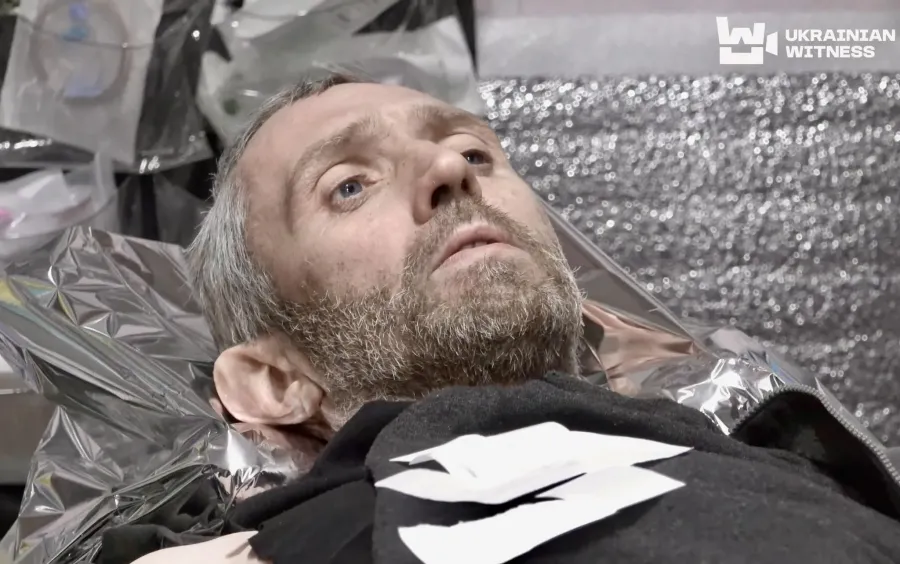 Пораненому бійцю довелося ампутувати обидві ноги