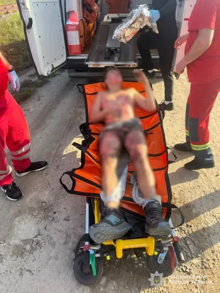 13-річний львів’янин мав намір зробити селфі на даху вагона-цистерни та був уражений електрострумом